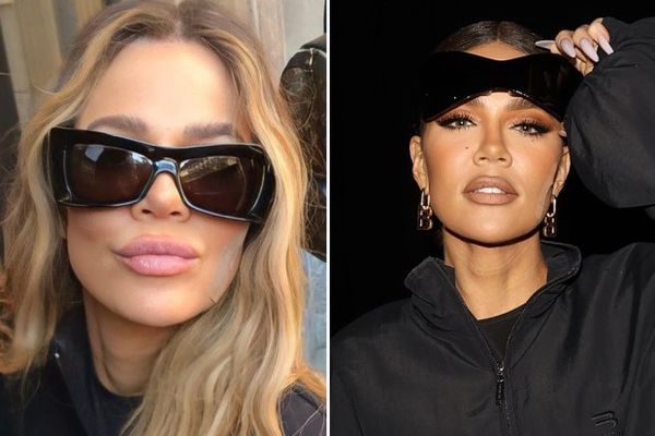 Understanding Khloe Kardashian’s Bandaged Face