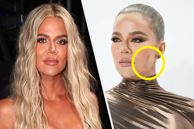 Why Khloe Kardashian is Wearing a Bandage on Her Face