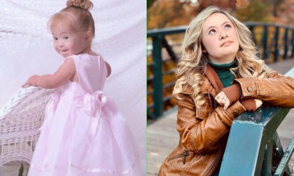 Girl With Down Syndrome Goes From Institution To Top Model