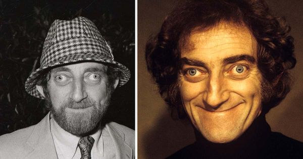 The Inspiring Life of Marty Feldman: A Comic Genius Who Embraced His Differences