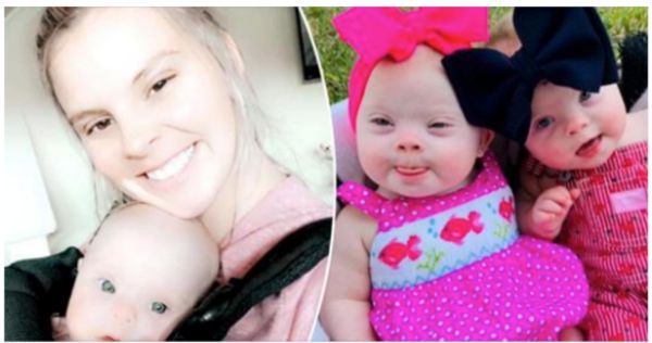 Embracing the Beauty of Rare Twins with Down Syndrome