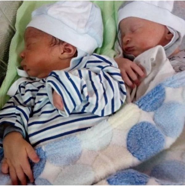 Mom of Black and White Twins: A Beautiful Surprise