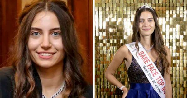 Inspiring the Beauty Within: Miss England Contestant Goes Makeup-Free