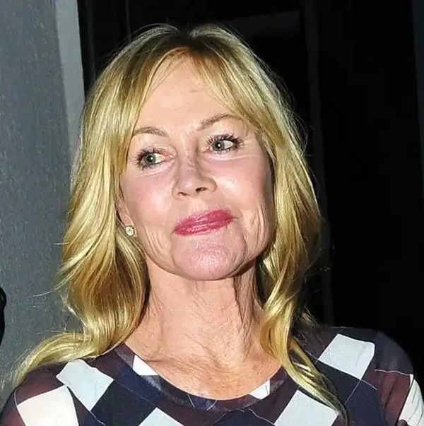 Melanie Griffith advocating for sun protection