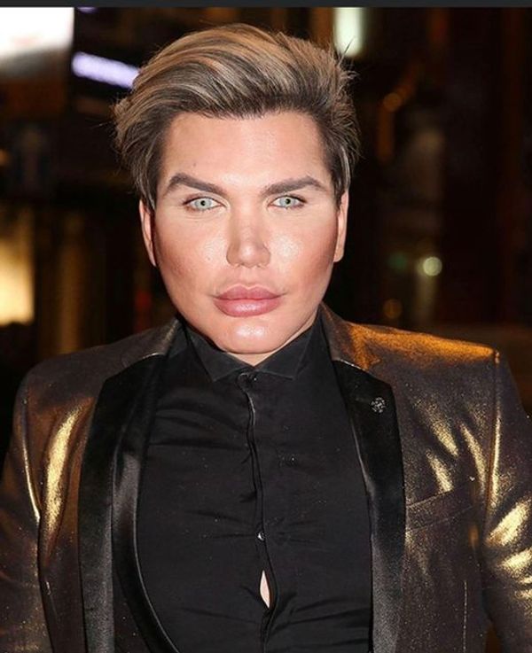 Rodrigo Alves: From “Ken to Barbie” – A Transformation Story