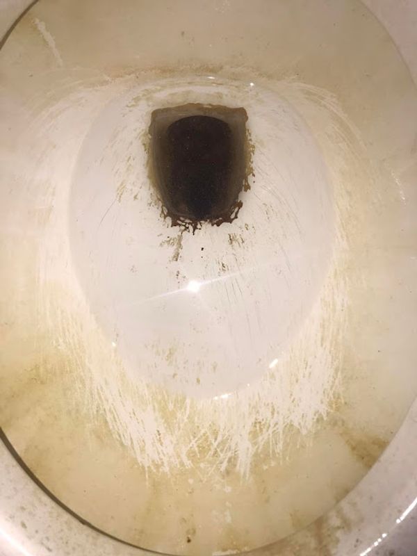 How to Easily Remove Hard Water Stains from Your Toilet Bowl