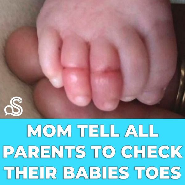 Mom Urges All Parents to Check Their Babies’ Toes