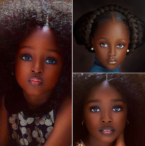 5-Year-Old Dubbed “Most Beautiful Girl in the World”