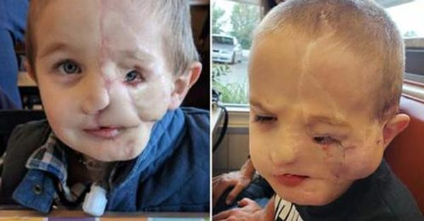 The Resilience of a 5-Year-Old Boy: Surviving a Vicious Attack and Overcoming the Labels