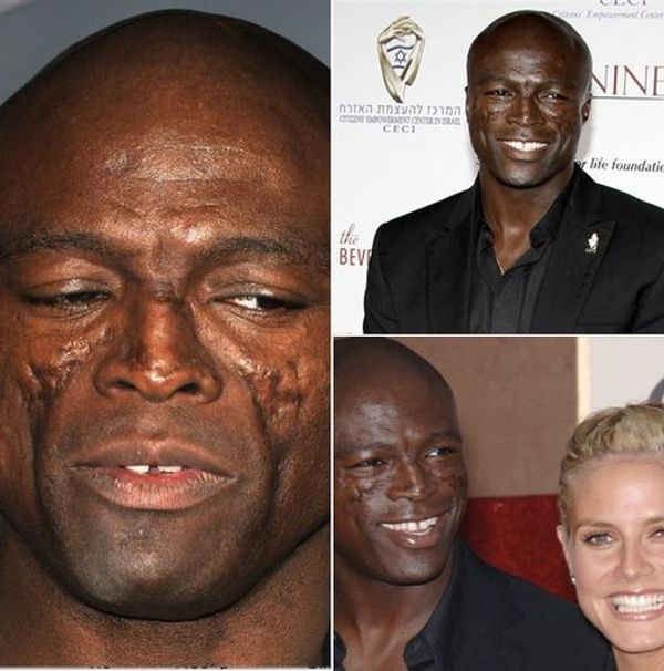 Seal’s Journey: From Music to Fame and Overcoming Challenges