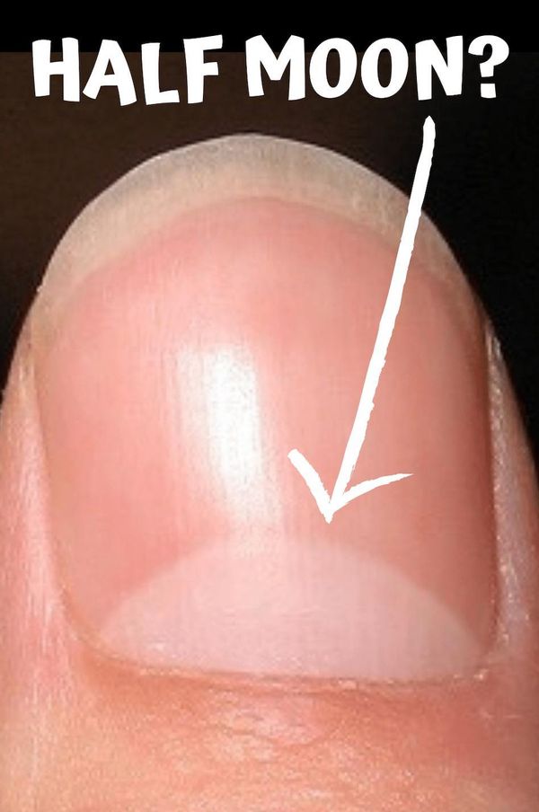 Keep an Eye on Your Fingernails: What They Reveal About Your Health